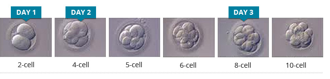 Stages of a Human Embryo Development